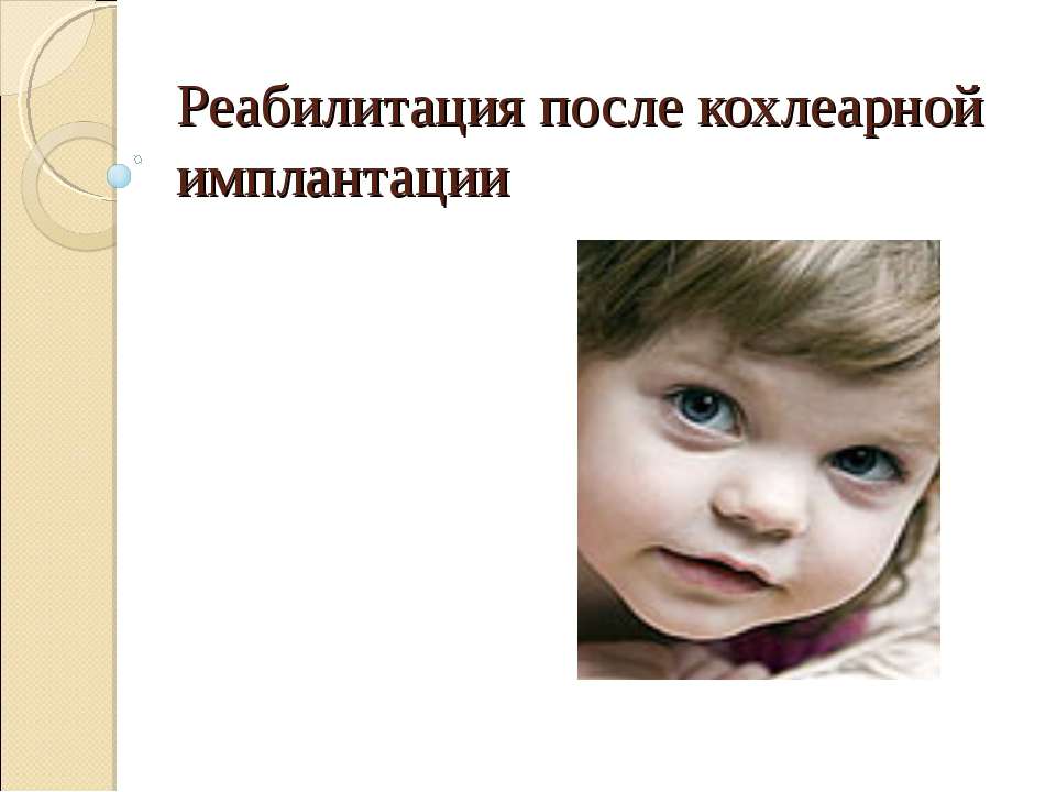Реабилитация после кохлеарной имплантации  - Скачать презентации бесплатно | Читать или скачать учебники для школы онлайн бесплатно ☑ Школьные учебники school-textbook.com