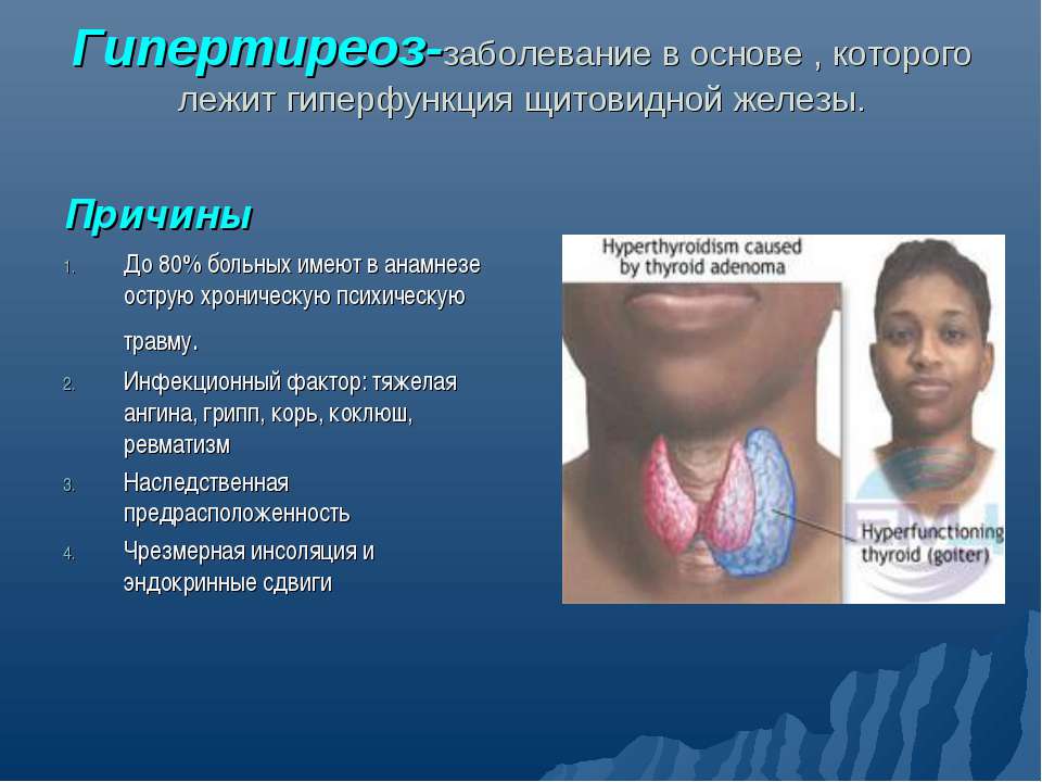 Гипертиреоз - Скачать презентации бесплатно ☑ Презентации по предметам на gdz-books.ru