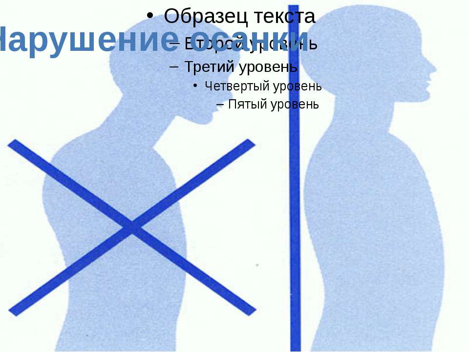 Нарушение осанки  - Скачать презентации бесплатно | Читать или скачать учебники для школы онлайн бесплатно ☑ Школьные учебники school-textbook.com