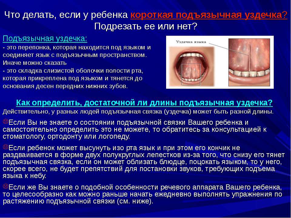 Что делать, если у ребенка короткая подъязычная уздечка?  - Скачать презентации бесплатно | Читать или скачать учебники для школы онлайн бесплатно ☑ Школьные учебники school-textbook.com
