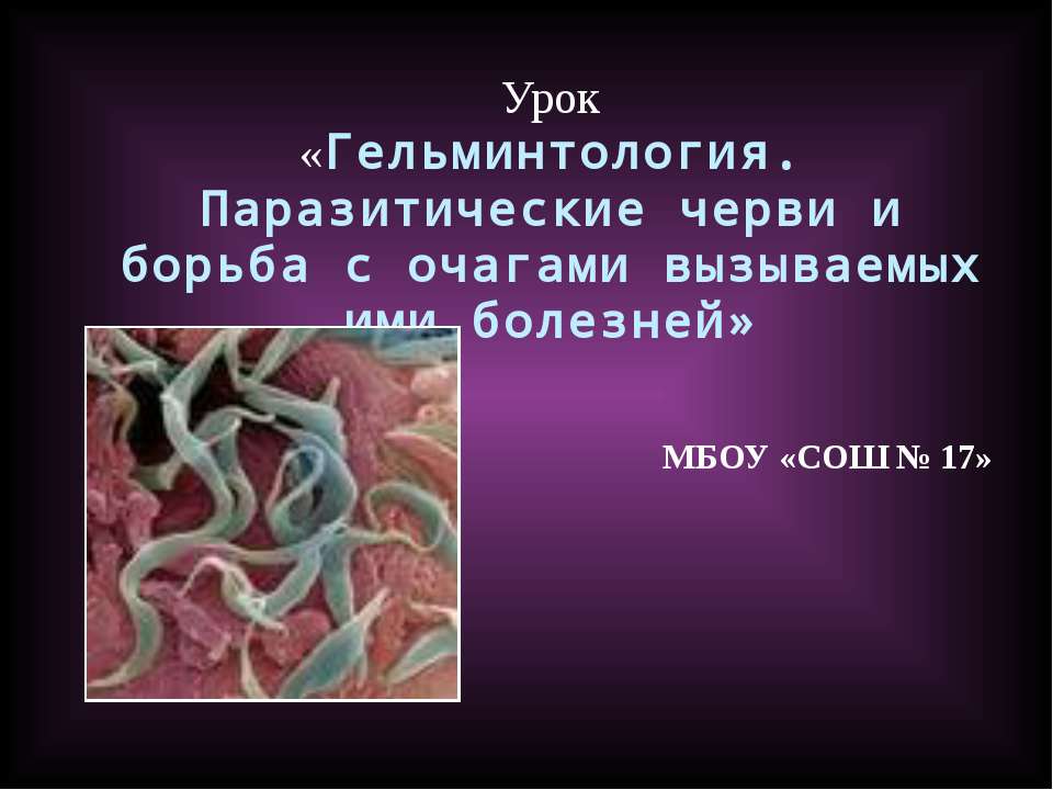 Гельминтология. Паразитические черви и борьба с очагами вызываемых ими болезней  - Скачать презентации бесплатно | Читать или скачать учебники для школы онлайн бесплатно ☑ Школьные учебники school-textbook.com