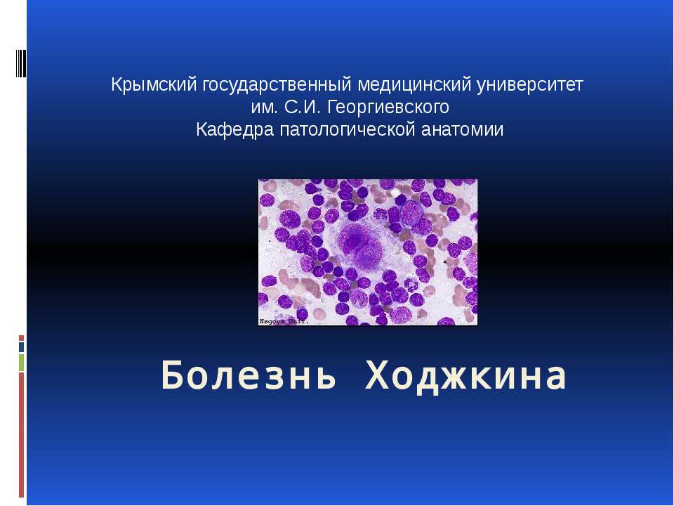 Болезнь Ходжкина - Скачать презентации бесплатно ☑ Презентации по предметам на gdz-books.ru