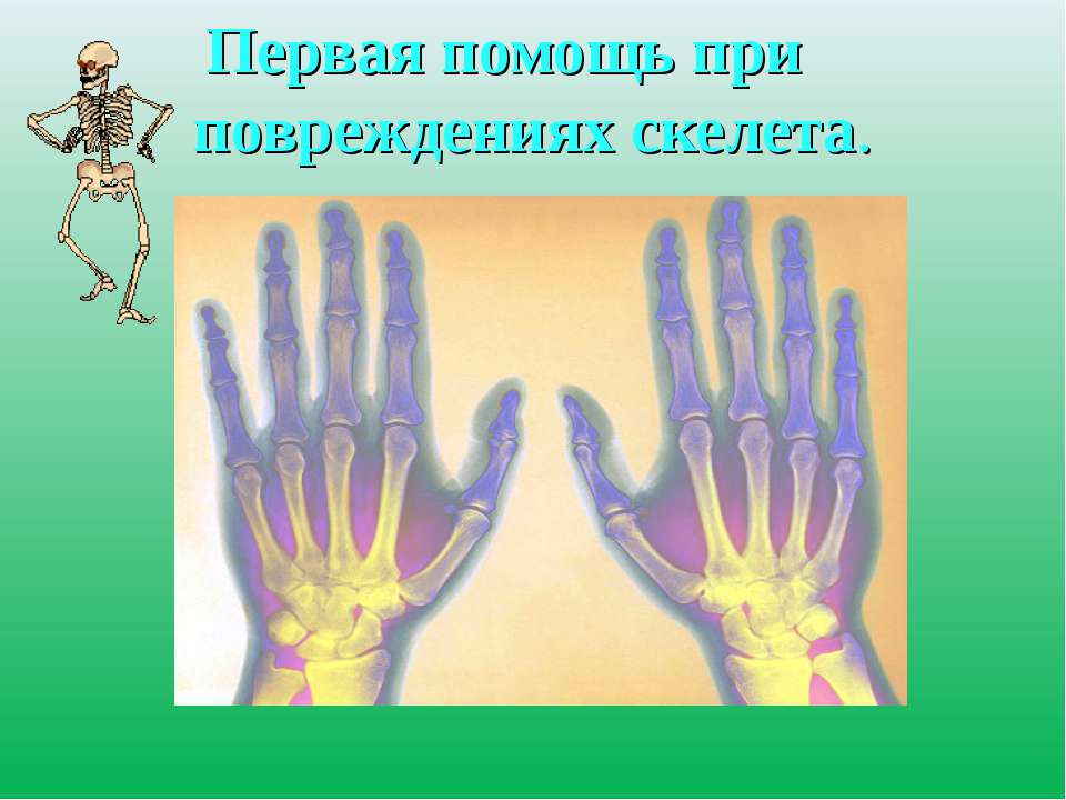 Первая помощь при повреждениях скелета  - Скачать презентации бесплатно | Читать или скачать учебники для школы онлайн бесплатно ☑ Школьные учебники school-textbook.com