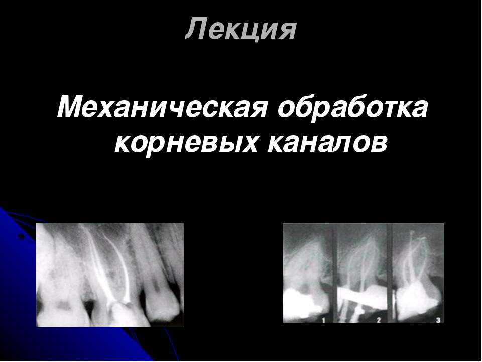 Механическая обработка корневых каналов  - Скачать презентации бесплатно | Читать или скачать учебники для школы онлайн бесплатно ☑ Школьные учебники school-textbook.com