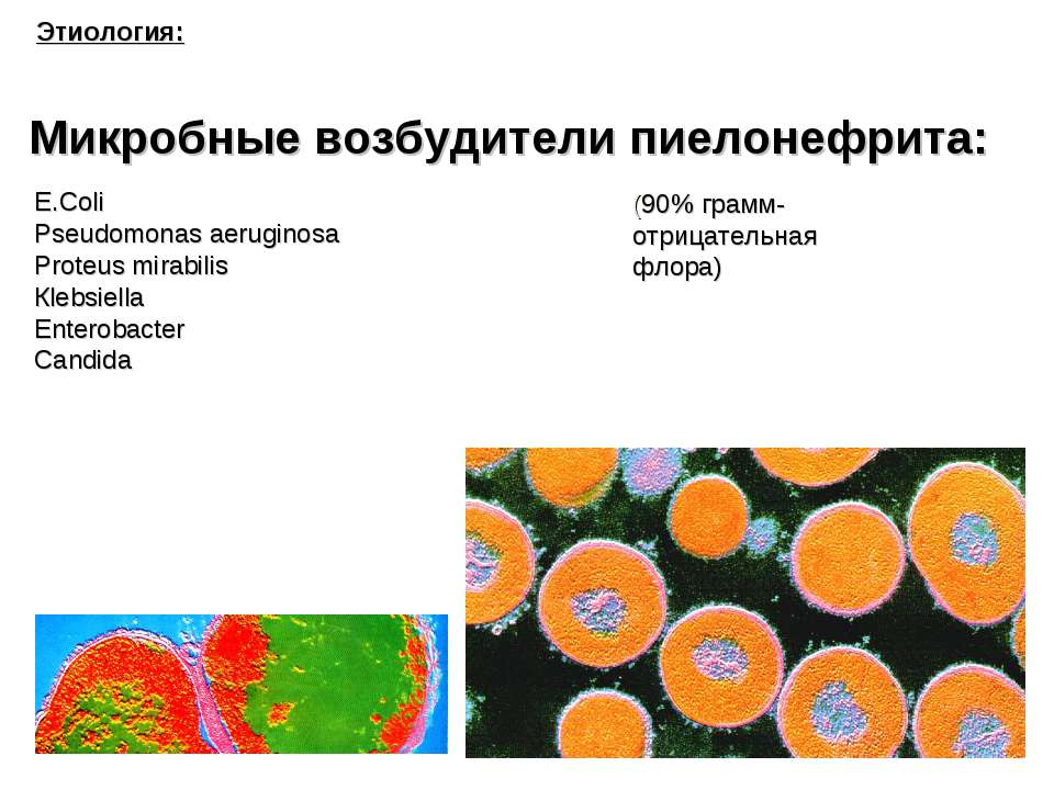 Микробные возбудители пиелонефрита - Скачать презентации бесплатно ☑ Презентации по предметам на gdz-books.ru