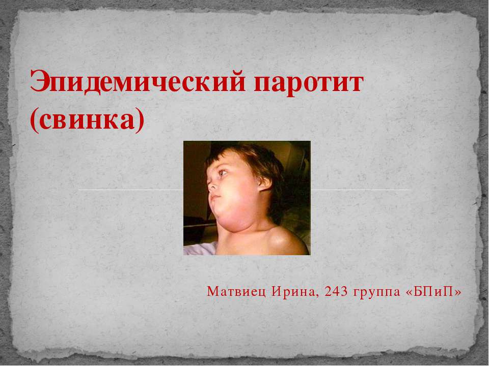 Эпидемический паротит (свинка) - Скачать презентации бесплатно ☑ Презентации по предметам на gdz-books.ru