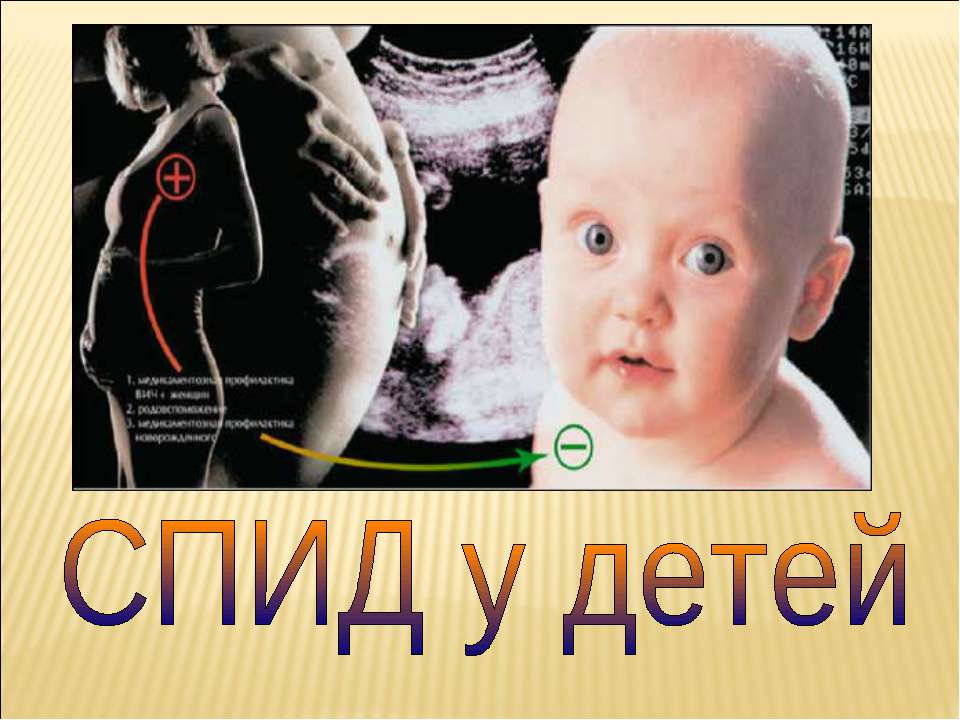 Спид удетей  - Скачать презентации бесплатно | Читать или скачать учебники для школы онлайн бесплатно ☑ Школьные учебники school-textbook.com