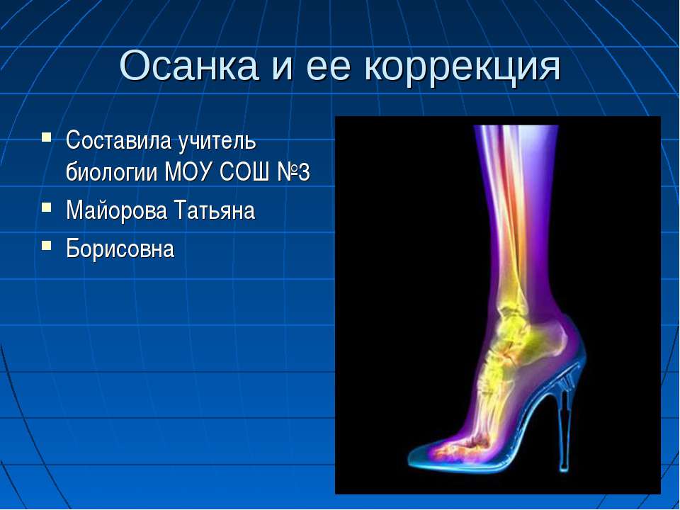 Осанка и ее коррекция  - Скачать презентации бесплатно | Читать или скачать учебники для школы онлайн бесплатно ☑ Школьные учебники school-textbook.com