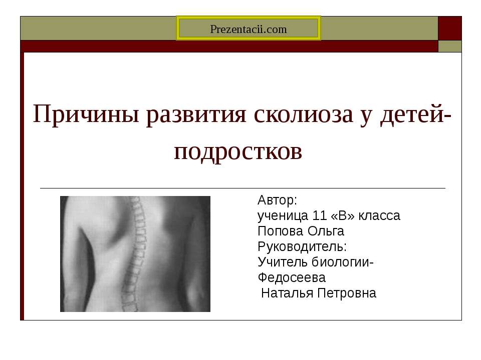 Причины развития сколиоза у детей-подростков - Скачать презентации бесплатно ☑ Презентации по предметам на gdz-books.ru